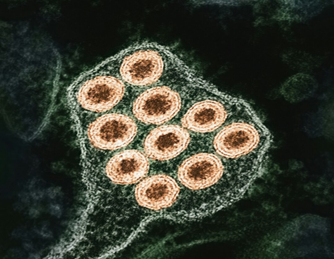 Rabies Death Case: Consumer Forum Rejects Insurer’s Restrictive Interpretation of ‘Accident’ in Policy Dispute