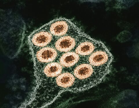Rabies Death Case: Consumer Forum Rejects Insurer’s Restrictive Interpretation of ‘Accident’ in Policy Dispute
